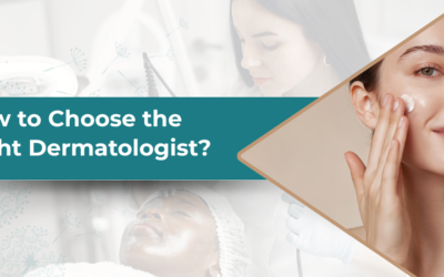 How to Choose the Right Dermatologist?