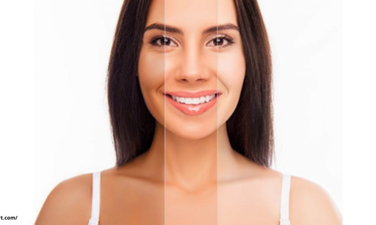 Skin Whitening Treatment Cost in Bangalore Dr Swetha Cosmo