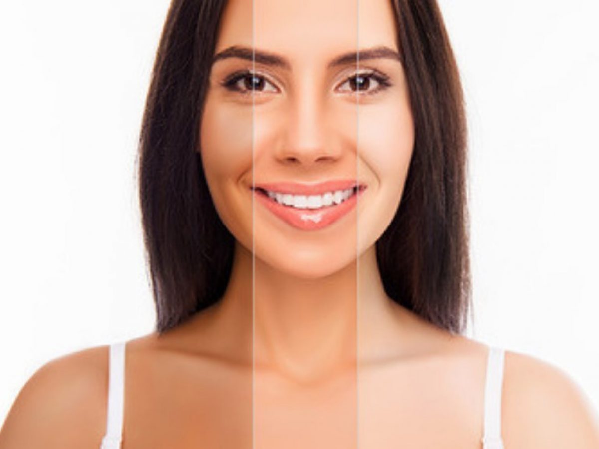 Skin Whitening Treatment Cost in Bangalore Dr Swetha Cosmo