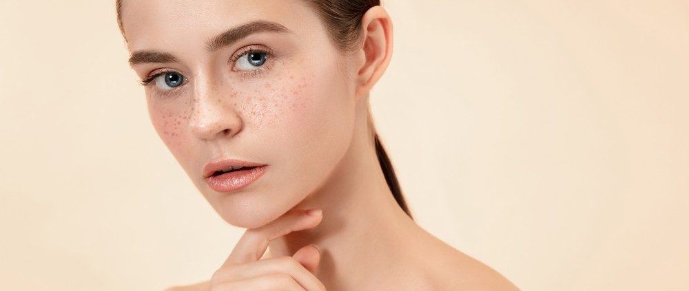 Freckle-treatment-bangalore