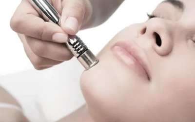 Everything You Need to Know About Microdermabrasion