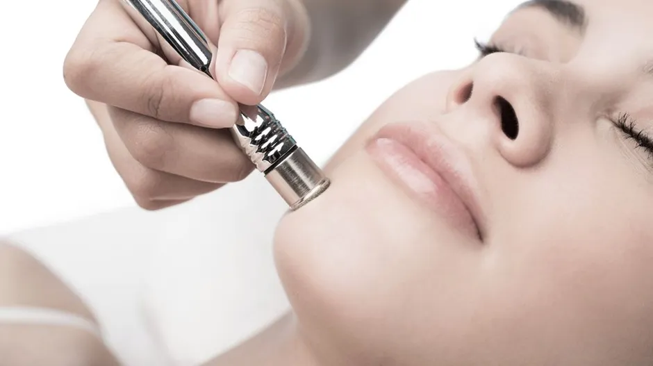 Everything You Need to Know About Microdermabrasion