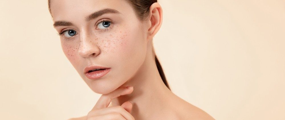 Freckle Control & Treatment in Indiranagar, Bangalore