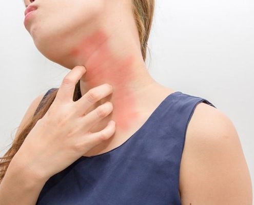 Best Skin Allergy Treatment in Indiranagar, Bangalore