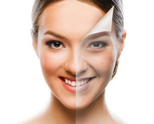 Skin Rejuvenation treatment