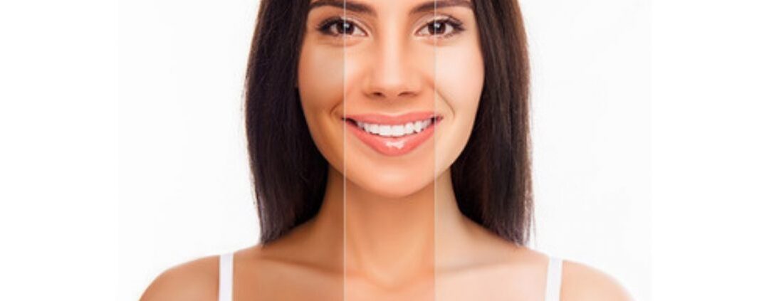 Skin Whitening Treatment & Cost in Bangalore