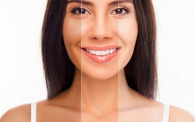 Skin Whitening Treatment & Cost in Bangalore