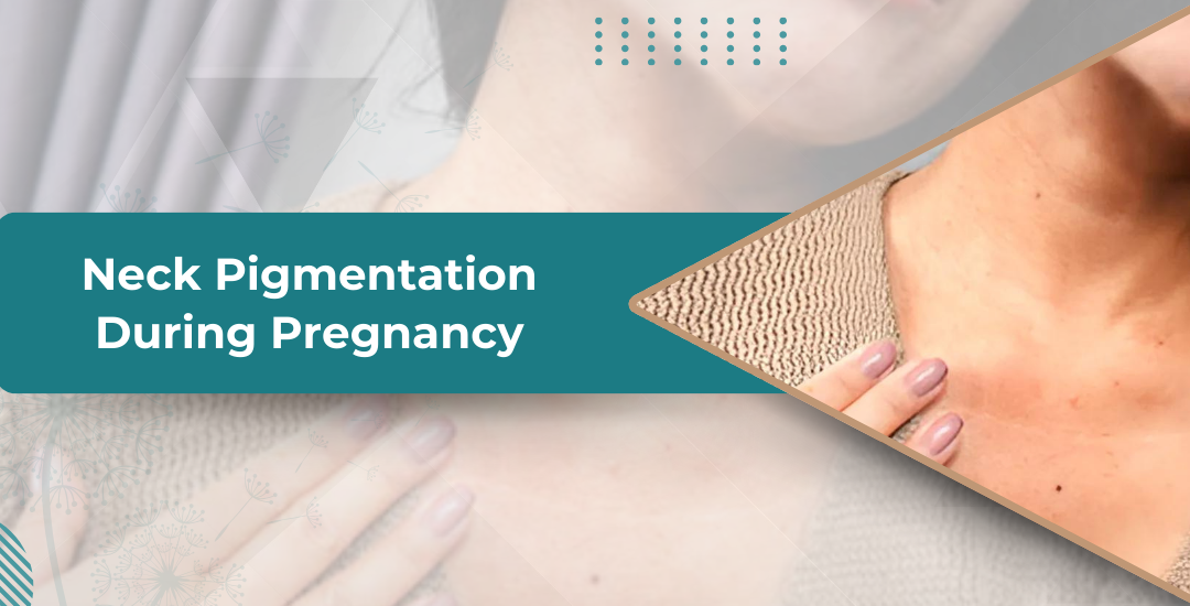 Neck Pigmentation During Pregnancy