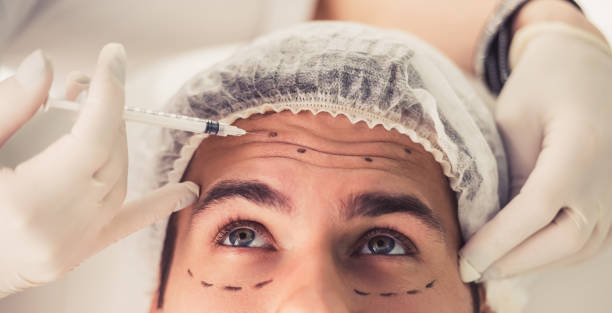 The Botox procedure What to expect