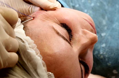 HydraFacial 1