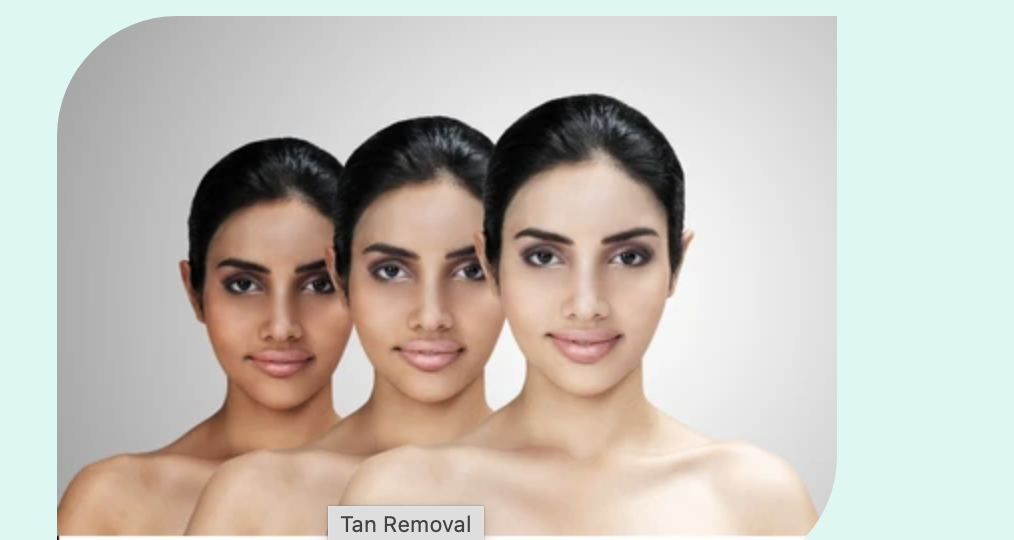 Tan Removal