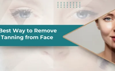 Best Way to Remove Tanning from Face