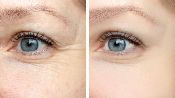 Enhances Eye Appearance