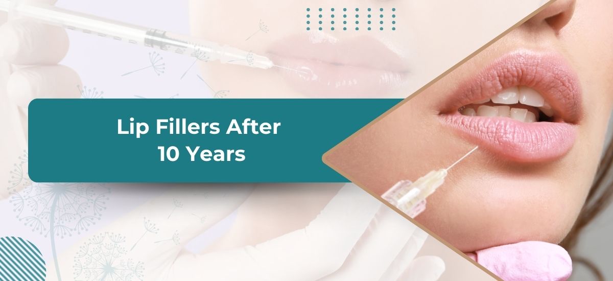 glutathione injection for lips 1 Lip Filler Injections in LA Dermal Fillers in Monroe, NJ