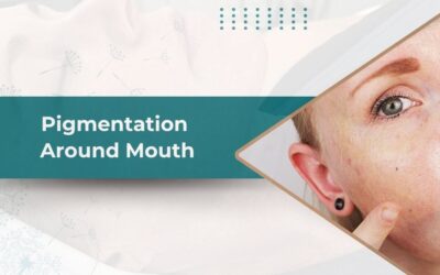Pigmentation Around the Mouth and Its Causes