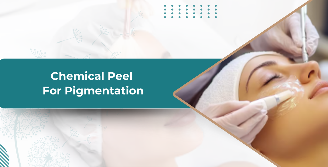 Chemical Peel for Pigmentation: What Works Best for Indian Skin