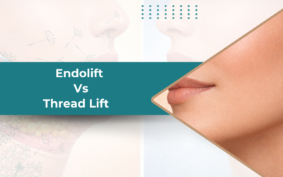 Endolift vs Thread Lift: Which One’s the Right Fit for You?