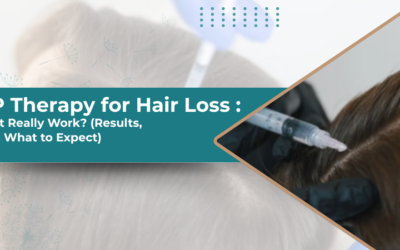 PRP Therapy for Hair Loss: Does It Really Work?