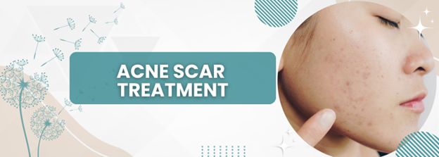Banner promoting acne scar treatment showing a close-up of a woman's cheek with acne scars and the text 'ACNE SCAR TREATMENT'