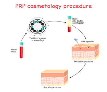 Picture11 | Dr Swetha Cosmodermcentre Hair
