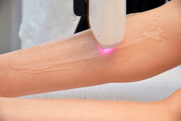 Cosmetic laser treatment on forearm with a device emitting pink light over gel-coated skin.