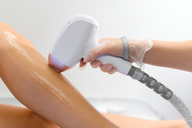 Close-up of a laser hair removal treatment on a leg, with a gloved clinician holding the handheld device against the skin on a shaved leg.
