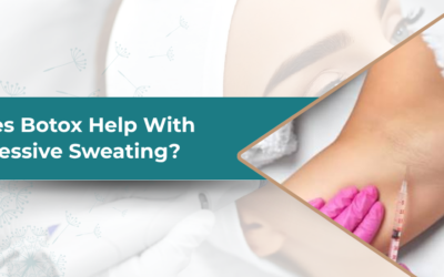 Does Botox Help With Excessive Sweating?