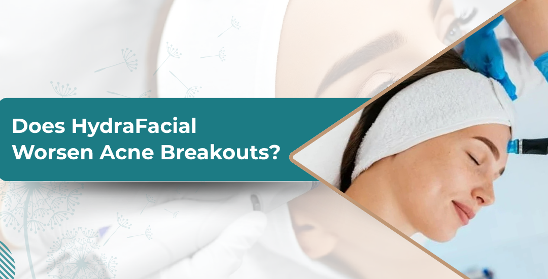Does HydraFacial Worsen Acne Breakouts