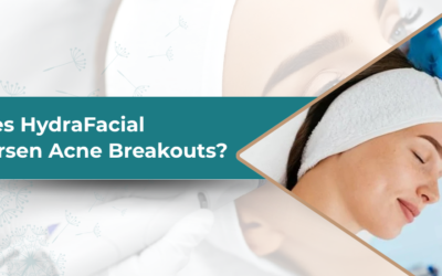 Does HydraFacial Worsen Acne Breakouts?