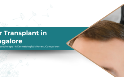 Hair Transplant in Bangalore: PRP vs Mesotherapy – A Dermatologist’s Honest Comparison