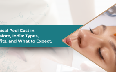 Chemical Peel Cost in Bangalore, India: Types, Benefits, and What to Expect