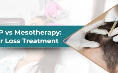 PRP vs Mesotherapy for Hair Loss: Which Is Better?