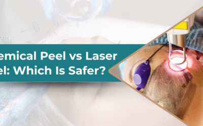 Chemical Peel vs Laser Peel: Which Is Safer for Your Skin?
