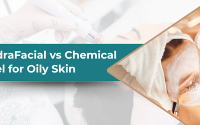 HydraFacial vs Chemical Peel: Which Suits Oily Skin?