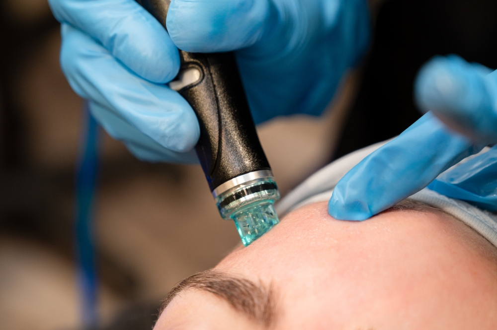Picture1447 | Dr Swetha Cosmodermcentre Thread Facelifts and Botox Each Last