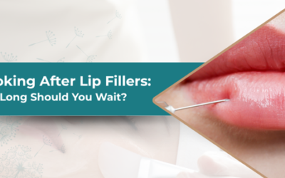 Smoking After Lip Fillers: How Long Should You Wait?