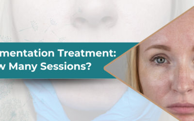 How Many Sessions Does Pigmentation Treatment Take?