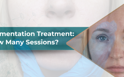 How Many Sessions Does Pigmentation Treatment Take?
