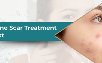 How Much Does Acne Scar Treatment Cost?