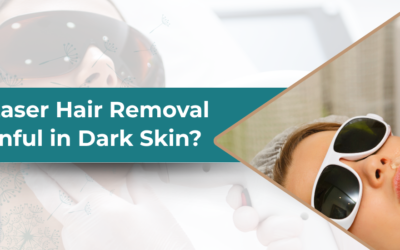 Is Laser Hair Removal Painful in Dark Skin?