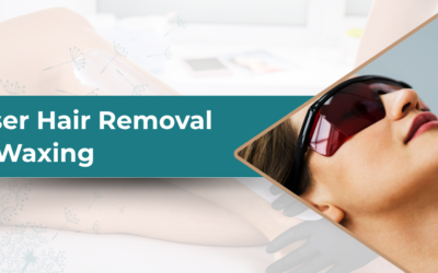 Is Laser Hair Removal More Permanent Than Waxing?